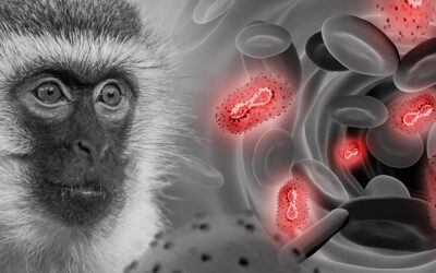 Viruela del Mono: Síntomas, Origen y Cómo Afecta a México